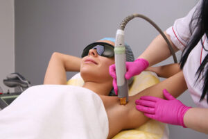 Laser Hair Removal